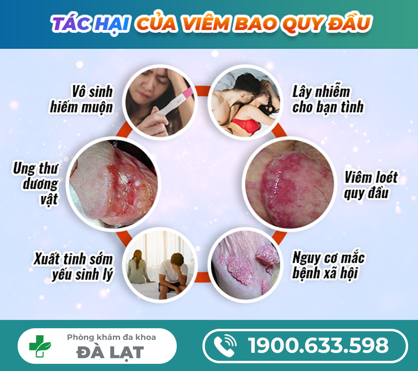 Hình ảnh minh họa